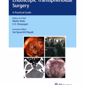 Endoscopic Transsphenoidal Surgery