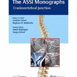 The ASSI Monographs—Craniovertebral Junction