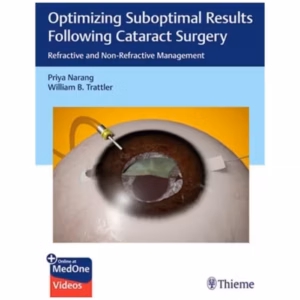 Optimizing Suboptimal Results Following Cataract Surgery 1st Ed.(Indian Reprint)
