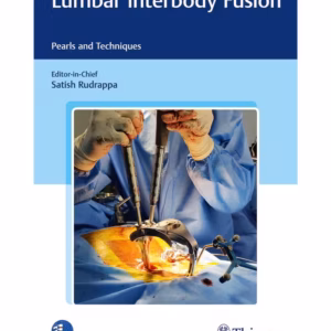 Lumbar Interbody Fusion 1st Ed.