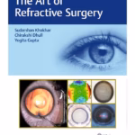 The Art of Refractive Surgery 1st Ed.