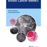 Breast Cancer Mimics 1st Ed.