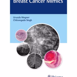 Breast Cancer Mimics 1st Ed.