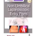 Non-Umbilical Laparoscopic Entry Ports