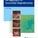 An Approach to Successful Stapedectomy -1st Edition