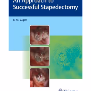 An Approach to Successful Stapedectomy -1st Edition