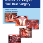 Atlas of 360 Degree Skull Base Surgery 1st Ed.