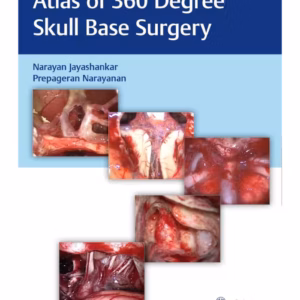 Atlas of 360 Degree Skull Base Surgery 1st Ed.