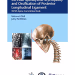 Cervical Spondylotic Myelopathy and OPLL 1st Ed.