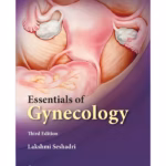 Essentials of Gynecology -3rd Edition