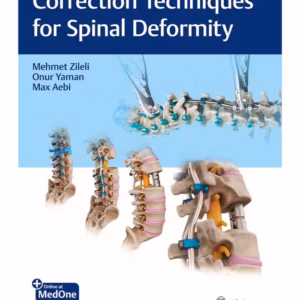 Correction Technoques for Spine Deformoty 1st Ed.