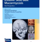 Invasive Skull Base Mucormycosis 1st Ed.