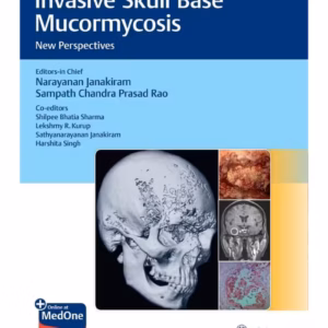 Invasive Skull Base Mucormycosis 1st Ed.