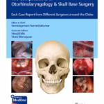 100 Complications of Otorhinolaryngology & Skull Base Surgery 1st Ed.