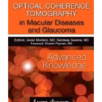 Optical Coherence Tomography In Macular Diseases And Glaucoma(Advanced Knowledge)